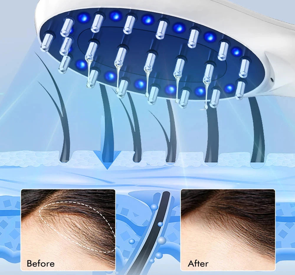 Brosse RF EMS LED ions négatifs applicateur d'huile